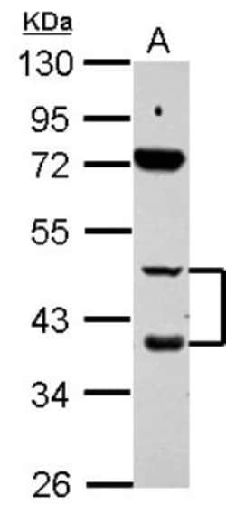 RAR beta/NR1B2 Antibody, Novus Biologicals 0.1mL; Unlabeled:Antibodies,