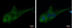 RASA3 Antibody, Novus Biologicals 0.1mL; Unlabeled:Antibodies, Polyclonal