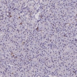 RASAL3 Antibody, Novus Biologicals 25 &mu;L, Unlabeled:Antibodies, Polyclonal