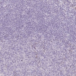 RASL10B Antibody, Novus Biologicals:Antibodies:Primary Antibodies