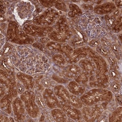 RASSF2 Antibody, Novus Biologicals:Antibodies:Primary Antibodies