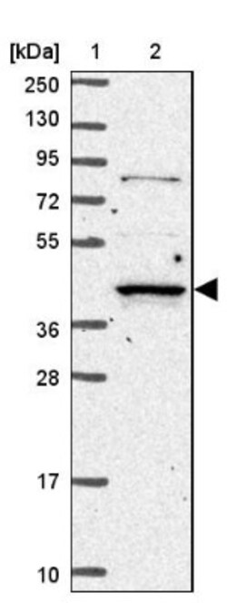 RASSF2 Antibody, Novus Biologicals:Antibodies:Primary Antibodies