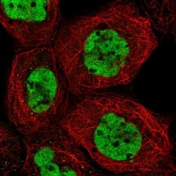RAVER1 Antibody, Novus Biologicals 0.1mL; Unlabeled:Antibodies, Polyclonal