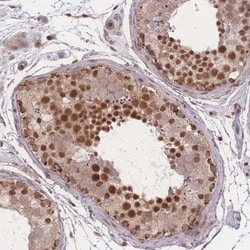 RAVER1 Antibody, Novus Biologicals 0.1mL; Unlabeled:Antibodies, Polyclonal