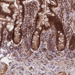 RAVER1 Antibody, Novus Biologicals 0.1mL; Unlabeled:Antibodies, Polyclonal