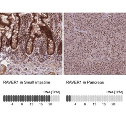 RAVER1 Antibody, Novus Biologicals 0.1mL; Unlabeled:Antibodies, Polyclonal