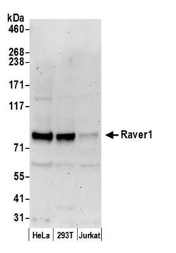 RAVER1 Antibody, Novus Biologicals 0.1mg; Unlabeled:Antibodies, Polyclonal