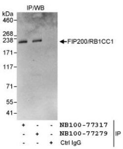 RB1CC1 Antibody, Novus Biologicals 0.1mg; Unlabeled:Antibodies, Polyclonal