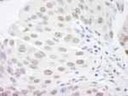 RBBP4/RbAp48 Antibody, Novus Biologicals 0.1mL; Unlabeled:Antibodies, Polyclonal