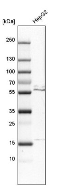 RBCK1 Antibody, Novus Biologicals 25 &mu;L; Unlabeled:Antibodies, Polyclonal