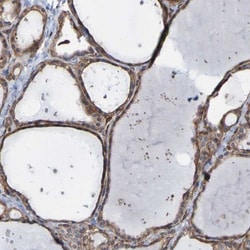 anti-RBED1, Polyclonal, Novus Biologicals 0.1mL; Unlabeled:Antibodies,