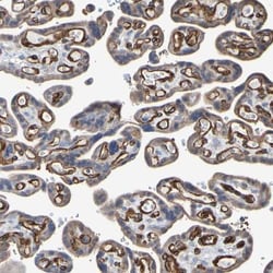 anti-RBED1, Polyclonal, Novus Biologicals 0.1mL; Unlabeled:Antibodies,
