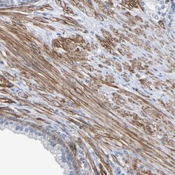anti-RBED1, Polyclonal, Novus Biologicals 0.1mL; Unlabeled:Antibodies,