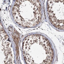 RBJ Antibody, Novus Biologicals 0.1mL; Unlabeled:Antibodies, Polyclonal