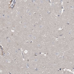 RBKS Antibody, Novus Biologicals 0.1mL; Unlabeled:Antibodies, Polyclonal