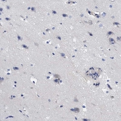 RBKS Antibody, Novus Biologicals 0.1mL; Unlabeled:Antibodies, Polyclonal