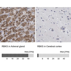 RBKS Antibody, Novus Biologicals 0.1mL; Unlabeled:Antibodies, Polyclonal