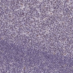 RBM12 Antibody, Novus Biologicals 0.1mL; Unlabeled:Antibodies, Polyclonal