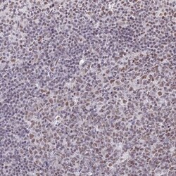 RBM12 Antibody, Novus Biologicals:Antibodies:Primary Antibodies