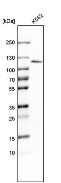 RBM15 Antibody, Novus Biologicals 0.1mL; Unlabeled:Antibodies, Polyclonal