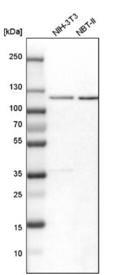 RBM15 Antibody, Novus Biologicals 0.1mL; Unlabeled:Antibodies, Polyclonal