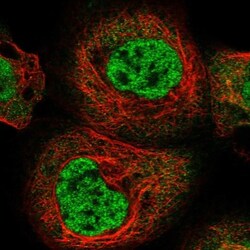 RBM15B Antibody, Novus Biologicals 25 &mu;L; Unlabeled:Antibodies, Polyclonal