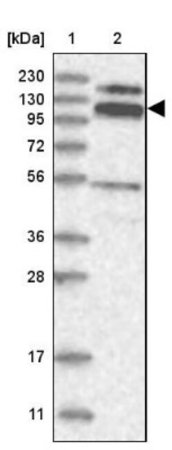 RBM15B Antibody, Novus Biologicals 25 &mu;L; Unlabeled:Antibodies, Polyclonal