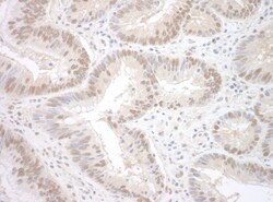 RBM17 Antibody, Novus Biologicals 0.1mL; Unlabeled:Antibodies, Polyclonal