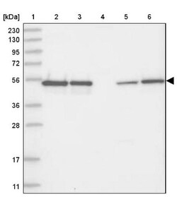 RBM17 Antibody, Novus Biologicals:Antibodies:Primary Antibodies