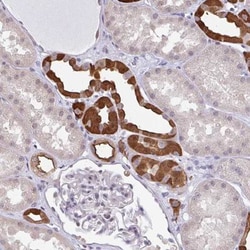 RBM18 Antibody, Novus Biologicals:Antibodies:Primary Antibodies