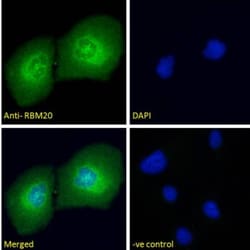 RBM20 Antibody, Novus Biologicals 0.1 mg | Buy Online | Novus Biologicals | Fisher Scientific