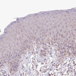 RBM20 Antibody, Novus Biologicals 25 &mu;L, Unlabeled:Antibodies, Polyclonal