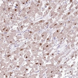 RBM20 Antibody, Novus Biologicals 25 &mu;L, Unlabeled:Antibodies, Polyclonal