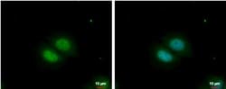 RBM22 Antibody, Novus Biologicals 0.1mL; Unlabeled:Antibodies, Polyclonal