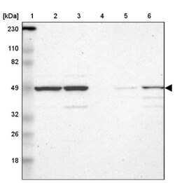 RBM22 Antibody, Novus Biologicals 0.1mL; Unlabeled:Antibodies, Polyclonal