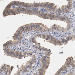 RBM23 Antibody, Novus Biologicals 25 &mu;L | Buy Online | Novus Biologicals | Fisher Scientific