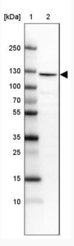 RBM25 Antibody, Novus Biologicals 0.1mL; Unlabeled:Antibodies, Polyclonal