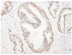 RBM26 Antibody, Novus Biologicals 0.1mL; Unlabeled:Antibodies, Polyclonal