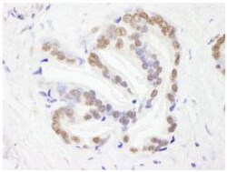 RBM26 Antibody, Novus Biologicals 0.1mL; Unlabeled:Antibodies, Polyclonal