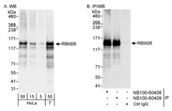 RBM26 Antibody, Novus Biologicals 0.1mL; Unlabeled:Antibodies, Polyclonal