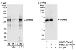 RBM26 Antibody, Novus Biologicals 0.1mL; Unlabeled:Antibodies, Polyclonal