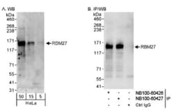 RBM27 Antibody, Novus Biologicals 0.1mg; Unlabeled:Antibodies, Polyclonal