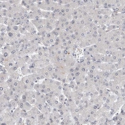 RBM28 Antibody, Novus Biologicals 25 &mu;L | Buy Online | Novus Biologicals | Fisher Scientific