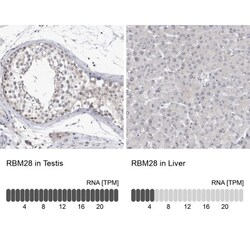 RBM28 Antibody, Novus Biologicals 25 &mu;L | Buy Online | Novus Biologicals | Fisher Scientific