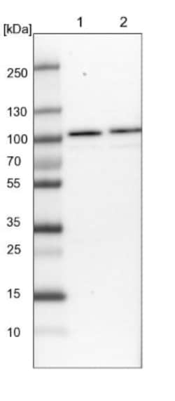 RBM28 Antibody, Novus Biologicals 25 &mu;L | Buy Online | Novus Biologicals | Fisher Scientific