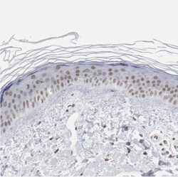 RBM3 Antibody, Novus Biologicals:Antibodies:Primary Antibodies