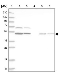 RBM34 Antibody, Novus Biologicals 0.1mL; Unlabeled:Antibodies, Polyclonal