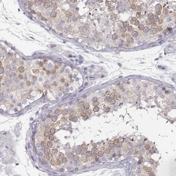 RBM44 Antibody, Novus Biologicals 25 &mu;L, Unlabeled:Antibodies, Polyclonal