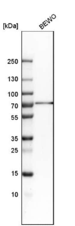 RBM47 Antibody, Novus Biologicals 0.1mL; Unlabeled:Antibodies, Polyclonal