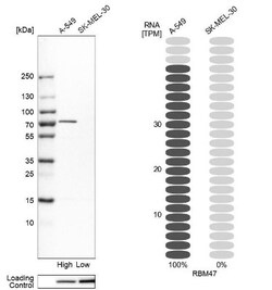 RBM47 Antibody, Novus Biologicals 0.1mL; Unlabeled:Antibodies, Polyclonal